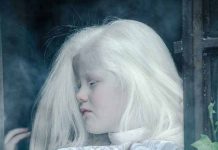 Albinismo. Mitos e tabus na série Invisíveis